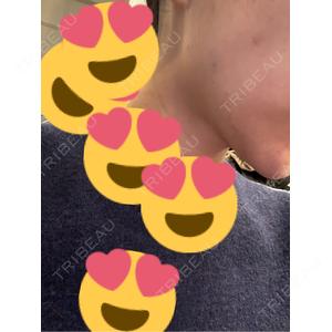 TCB東京中央美容外科 TCB東京中央美容外科 町田院口コミ