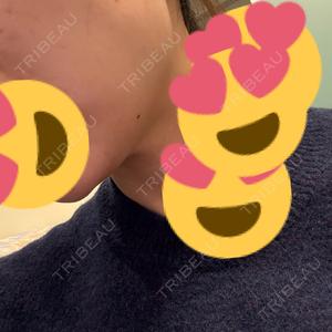 TCB東京中央美容外科 TCB東京中央美容外科 町田院口コミ