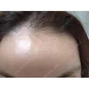 湘南美容クリニック 湘南美容クリニック 仙台院口コミ