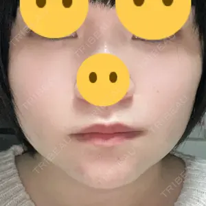 HAAB×DREAM BEAUTY CLINIC HAAB×DREAM BEAUTY CLINIC 東京本院口コミ