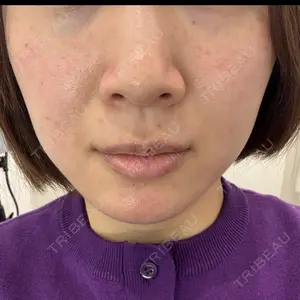 APスキンクリニック銀座口コミ