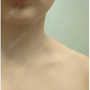 湘南美容クリニック 湘南美容クリニック 新橋銀座口院口コミ