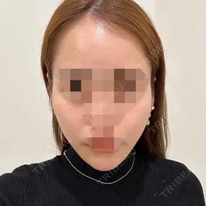 口コミ