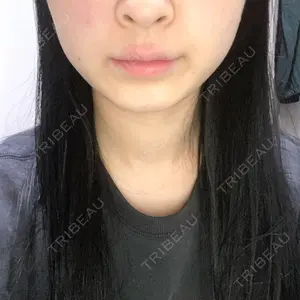 口コミ