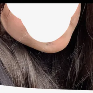 DMTC美容皮膚科 DMTC美容皮膚科 渋谷院口コミ