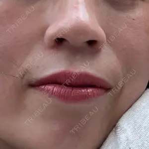 APスキンクリニック銀座口コミ