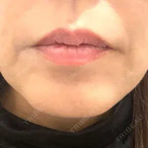 TCB東京中央美容外科 神戸院の