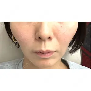 おおかみ美容のクリニック おおかみ美容のクリニック 新宿院口コミ