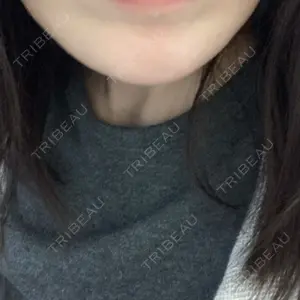 口コミ