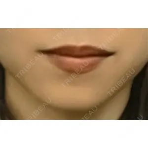 R Beauty CLINIC R Beauty CLINIC 銀座院口コミ