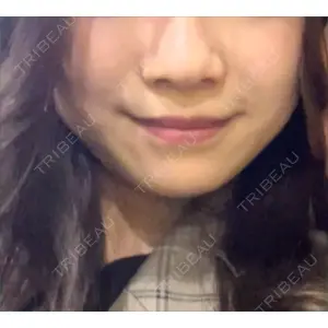 YBC横浜美容外科 YBC横浜美容外科 立川院口コミ