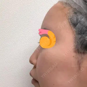 もとび美容外科クリニック 新宿院口コミ