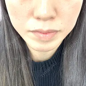 ルラ美容クリニック ルラ美容クリニック 大阪本院口コミ
