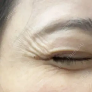 PRO CLINIC プロクリニック 銀座院口コミ