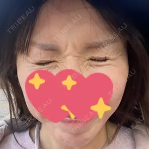 TCB東京中央美容外科 TCB東京中央美容外科 福岡天神院口コミ