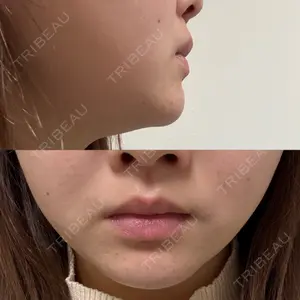 TCB東京中央美容外科 TCB東京中央美容外科 新宿東口院口コミ