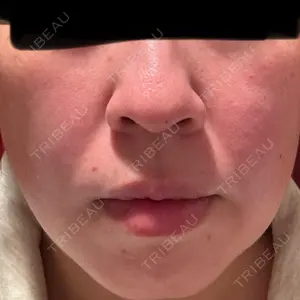 おおかみ美容のクリニック おおかみ美容のクリニック 新宿院口コミ