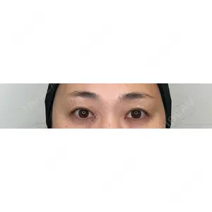PRO CLINIC プロクリニック 銀座院口コミ