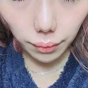 口コミ