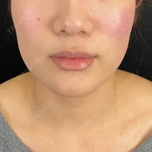 藤・ナチュレ美容クリニック 藤・ナチュレ美容クリニック 銀座院口コミ