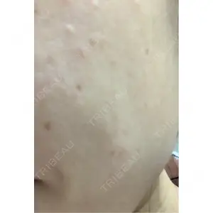 RAISE CLINIC 【レイズクリニック】口コミ