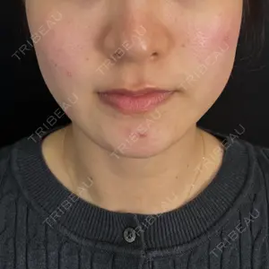 藤・ナチュレ美容クリニック 藤・ナチュレ美容クリニック 銀座院口コミ