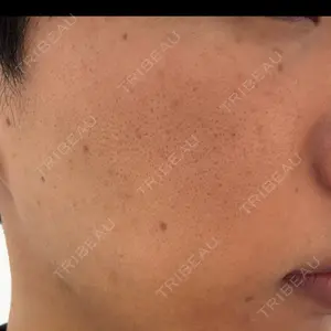 9BeautyClinic口コミ