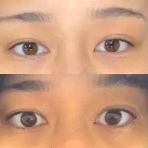 新未来クリニック口コミ