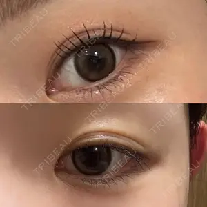 湘南美容クリニック 新宿本院口コミ