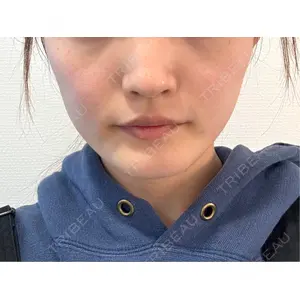 東京シンデレラ美容外科 東京シンデレラ美容外科 池袋院口コミ