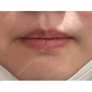 口コミ