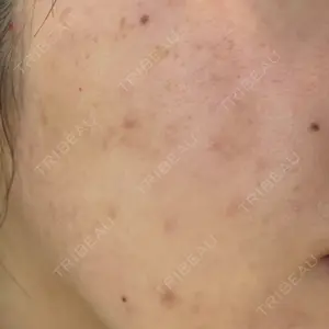 RAISE CLINIC 【レイズクリニック】口コミ