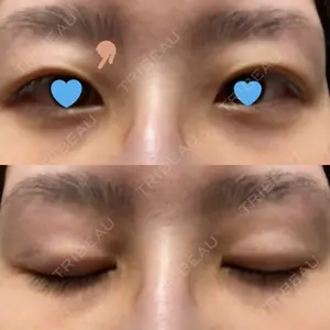 いちのせ形成外科・皮膚科 眼瞼＆フェイスクリニック口コミ