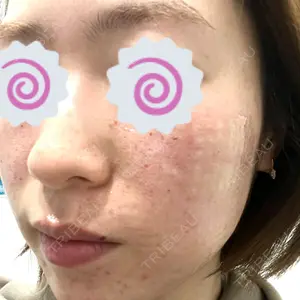 スマートスキンクリニック スマートスキンクリニック 神保町院口コミ