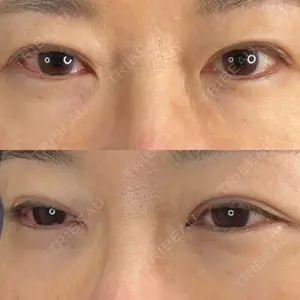藤・ナチュレ美容クリニック 藤・ナチュレ美容クリニック 銀座院口コミ