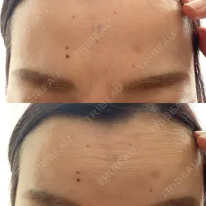 ルラ美容クリニック ルラ美容クリニック 町田院口コミ