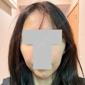 口コミ