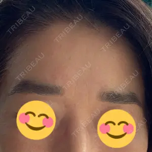 APスキンクリニック銀座口コミ