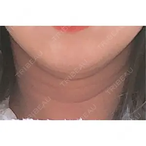 梅田すずらんクリニック口コミ