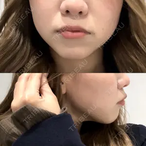 フォンタナクリニック天神口コミ