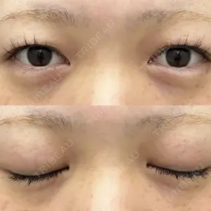 渋谷の森クリニック口コミ