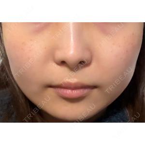 LOUIS CLINIC 二子玉川院【ルイクリニック】口コミ