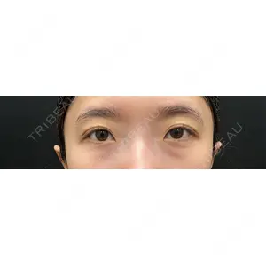 藤・ナチュレ美容クリニック 藤・ナチュレ美容クリニック 銀座院口コミ