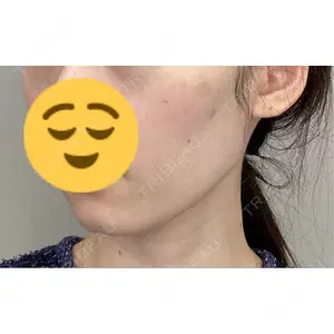 東京美容クリニックの口コミ