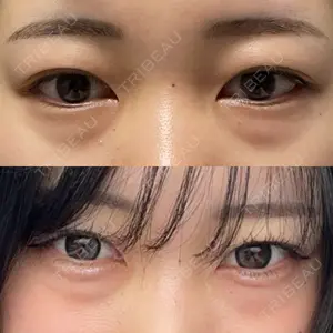 口コミ