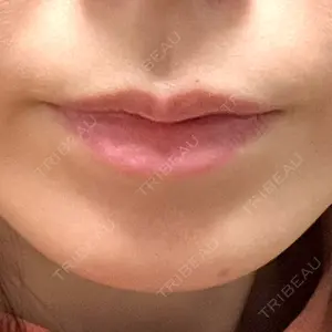 APスキンクリニック銀座口コミ