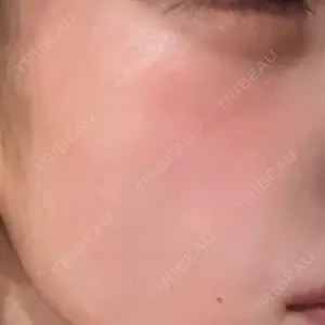 アスク美容クリニック銀座口コミ