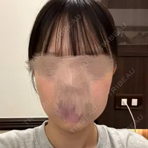 セギム美容整形外科口コミ