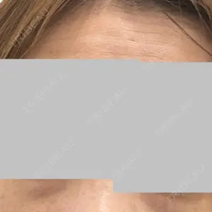 TCB東京中央美容外科 TCB東京中央美容外科 船橋院口コミ