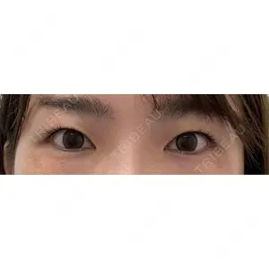口コミ